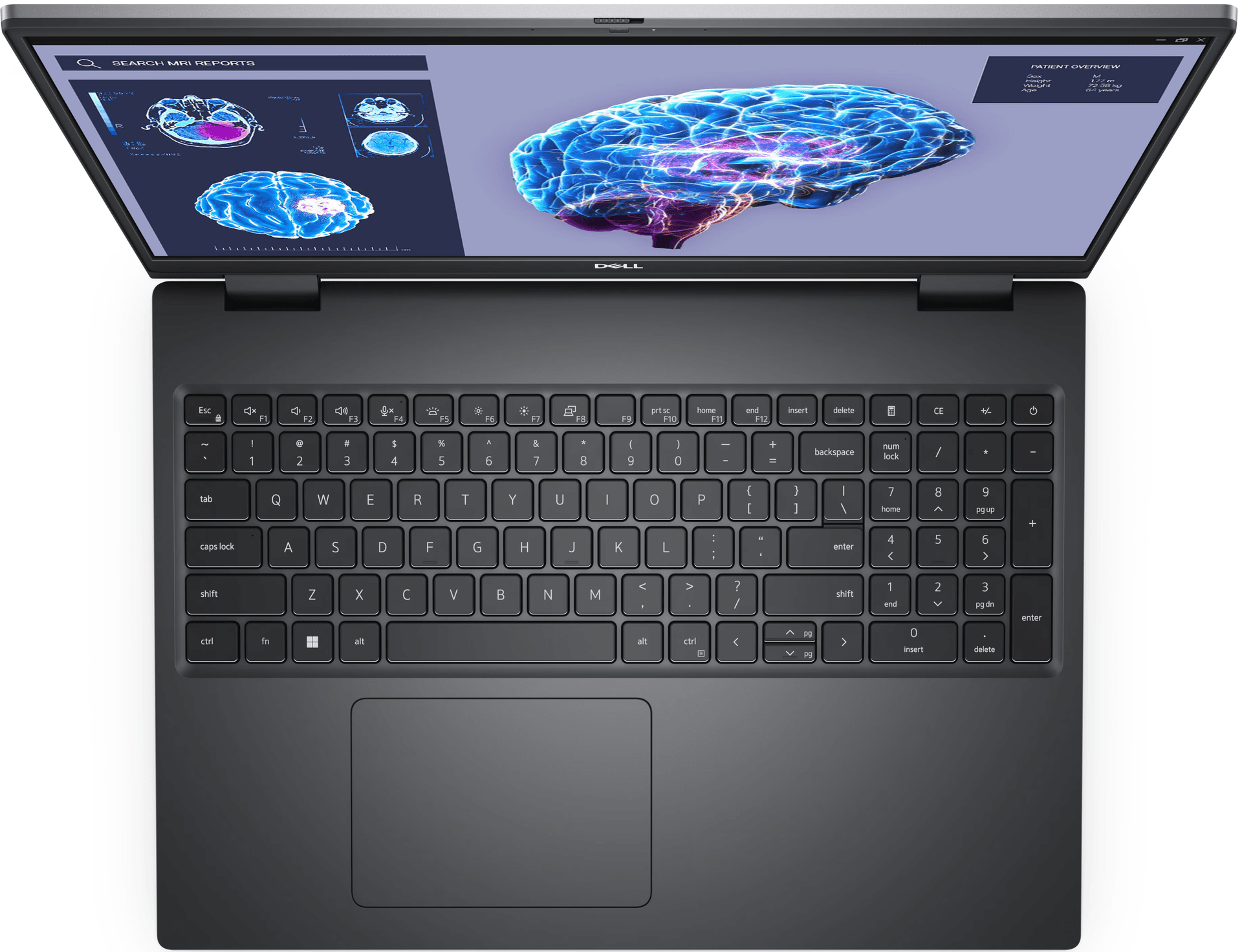 Laptop LAPTOP DELL PRECISION 7680 i7 13850HX RAM 32GB SSD 1TB RTX A1000 6GB Laptop LAPTOP DELL PRECISION 7680 i7 13850HX RAM 32GB SSD 1TB RTX A1000 6GB
