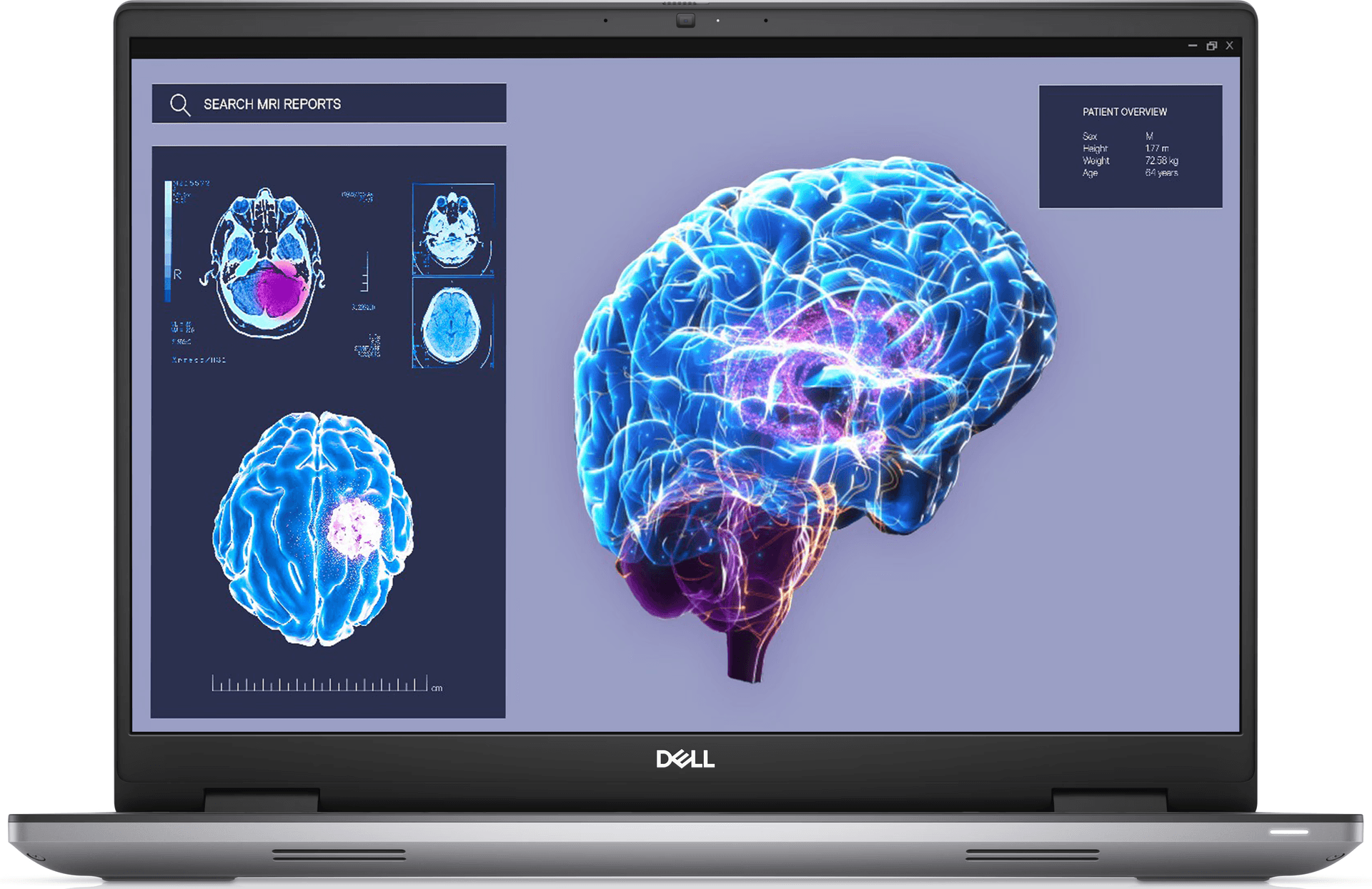 Laptop LAPTOP DELL PRECISION 7680 i7 13850HX RAM 32GB SSD 1TB RTX A1000 6GB Laptop LAPTOP DELL PRECISION 7680 i7 13850HX RAM 32GB SSD 1TB RTX A1000 6GB